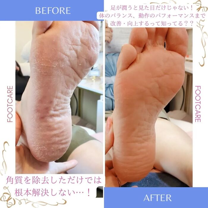 画像322