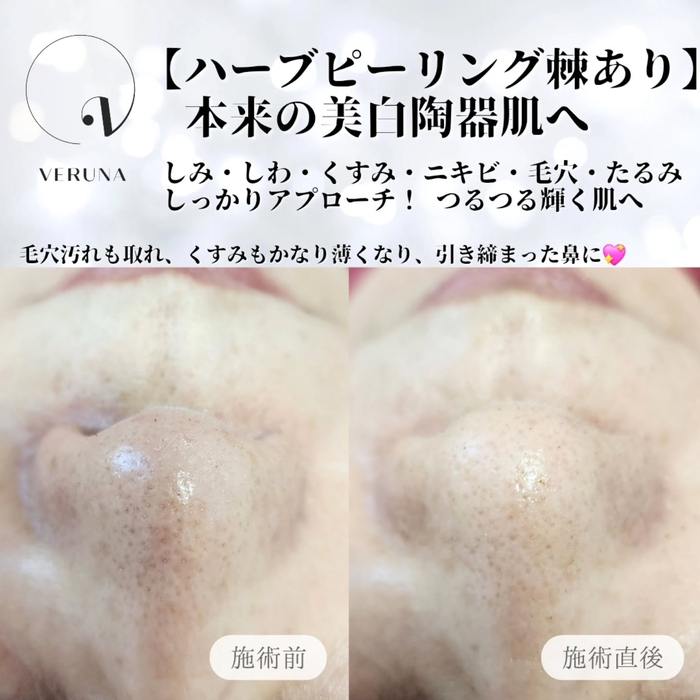 画像869