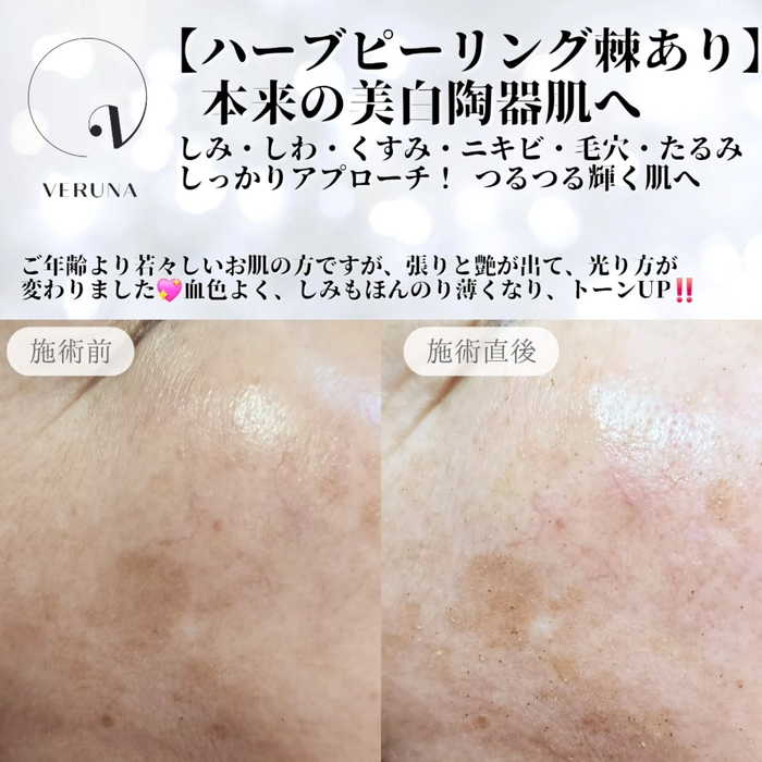 画像870