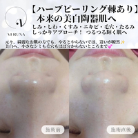 画像881